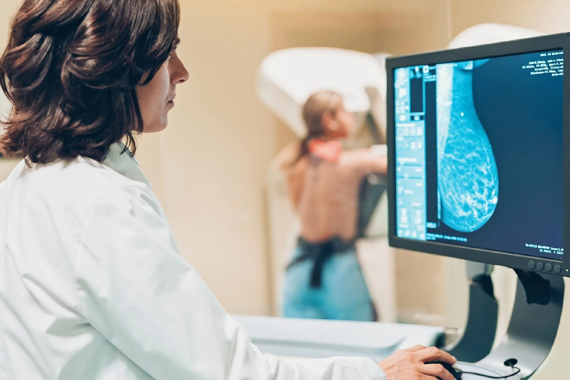 mamografia-monitor-1572447018622_v2_1920x1280.jpg